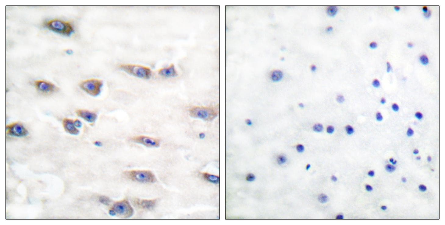 NTRK1 / TrkA Antibody (phospho-Tyr791)