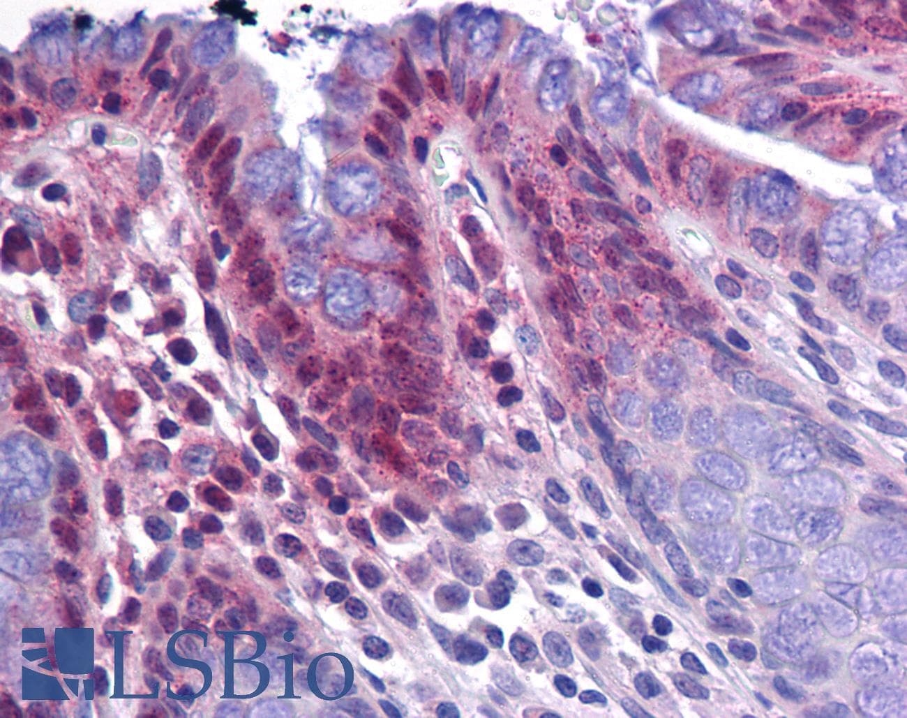 IHC-plus™ Polyclonal Rabbit anti-Human KPNA3 / Importin Alpha 4 Antibody (IHC, IF, WB)