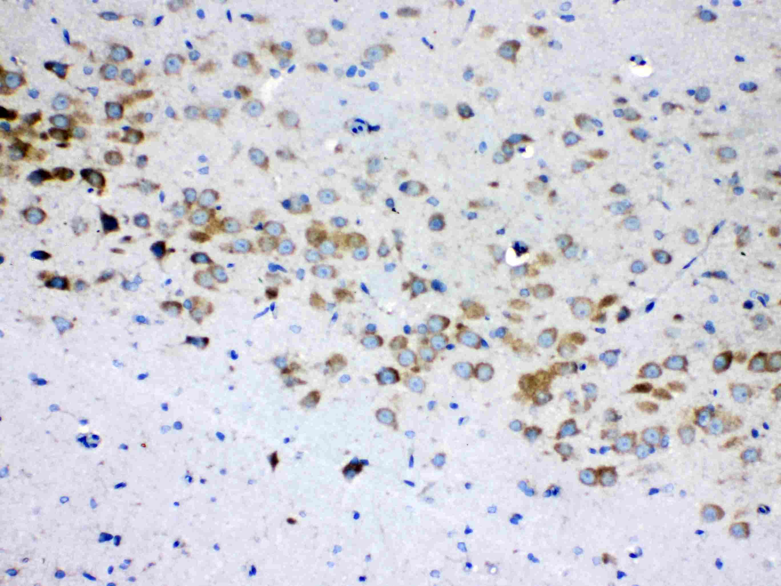 Polyclonal Rabbit anti-Human RPS6 / Ribosomal Protein S6 Antibody (IHC, WB)