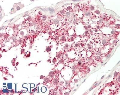 IHC-plus™ SEMA3E / Semaphorin 3E Antibody