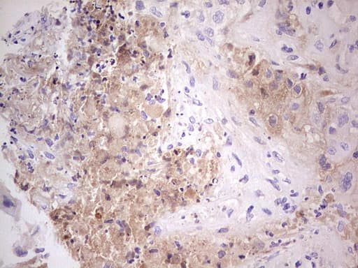 CFI / Complement Factor I Antibody (aa340-583, clone OTI7C9, Carrier-free)