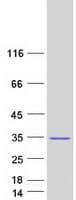 Human MRAS Protein (Recombinant Myc-DDK (Flag))