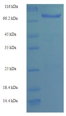 Mouse CTCFL / BORIS Protein (Recombinant His-SUMO)