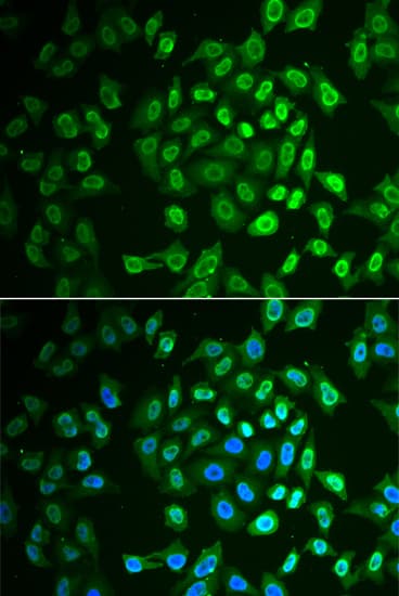 Polyclonal Rabbit anti-Human FAH Antibody (IHC, IF, WB)