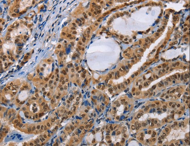 BAG1 / BAG-1 Antibody