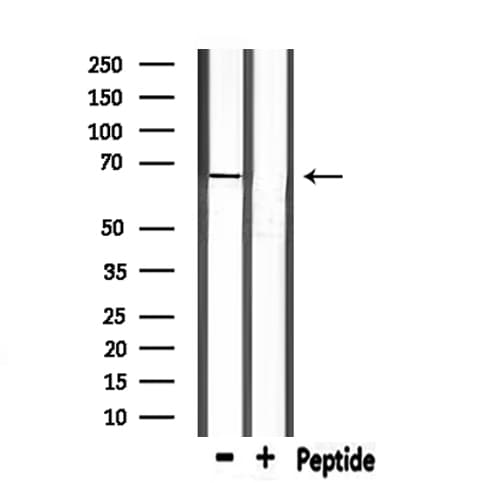 Polyclonal Rabbit anti-Human PCK1 Antibody (IHC, WB)