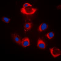 BAX Antibody (Internal)