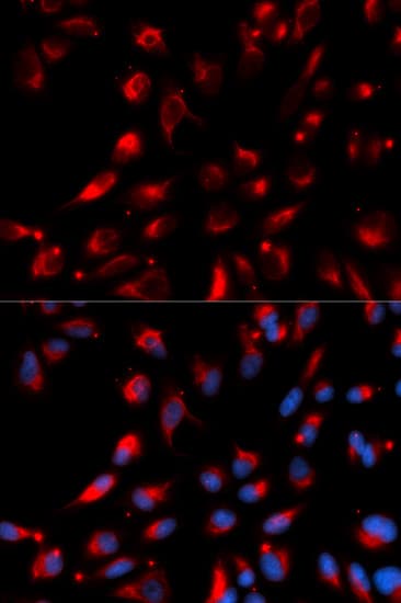 CPE / Carboxypeptidase E Antibody