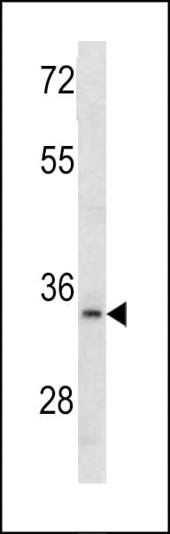 AIMP1 / EMAP II Antibody (aa242-268)