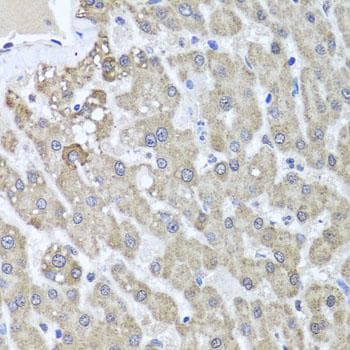 ALKBH4 Antibody