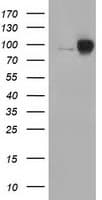 CTNNB1 / Beta Catenin Antibody (clone OTI5D2)