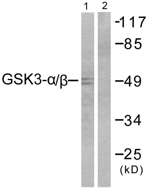 Polyclonal Rabbit anti-Human GSK3A / GSK3 Alpha Antibody (p279/216, IHC, WB)