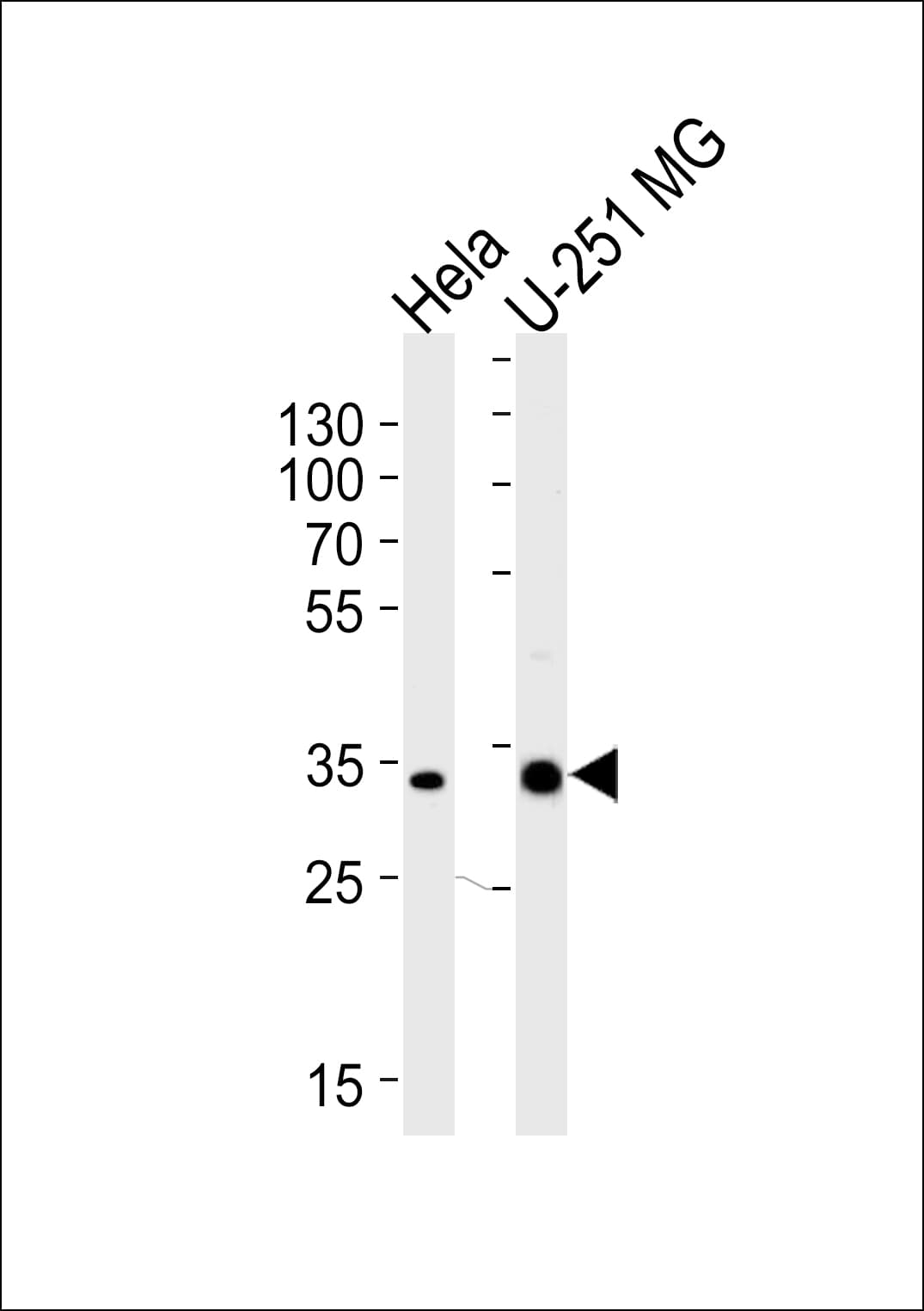 TAF8 Antibody (aa151-178)