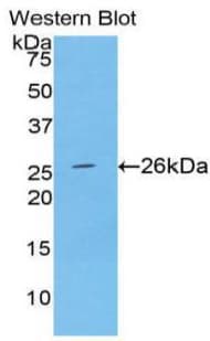 SPTAN1 / Alpha Fodrin Antibody (aa842-1058)
