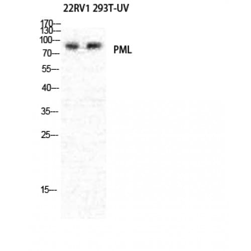PML Antibody (30-110 aa, N-terminal)