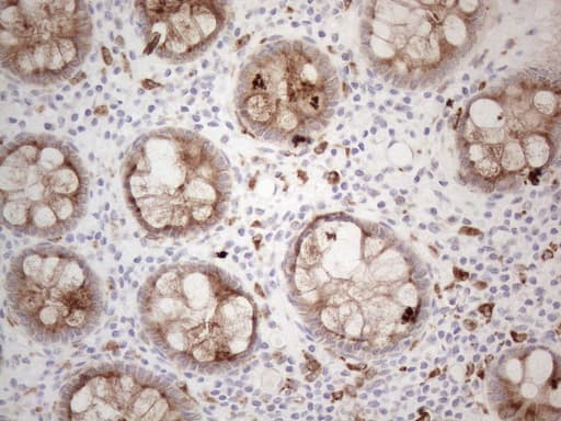 GRN / Granulin Antibody (aa327-593, clone OTI4B9)