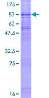 Human FLVCR / FLVCR1 Protein (Recombinant GST)
