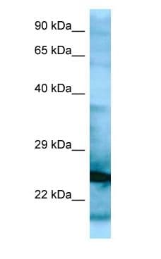 Polyclonal Rabbit anti-Human RPL15 / Ribosomal Protein L15 Antibody (aa34-83, WB)