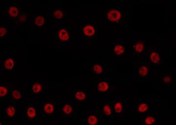 Polyclonal Rabbit anti-Human MCM5 Antibody (IHC, IF, WB)