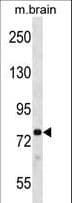 Polyclonal Rabbit anti-Mouse PRKCB / PKC-Beta Antibody (aa1-30, IHC, WB)