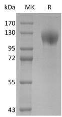 Coronavirus SARS-CoV-2 S1 Protein (Recombinant)