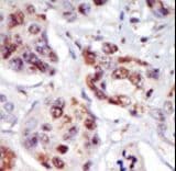 PIP4K2C Antibody (aa333-364)