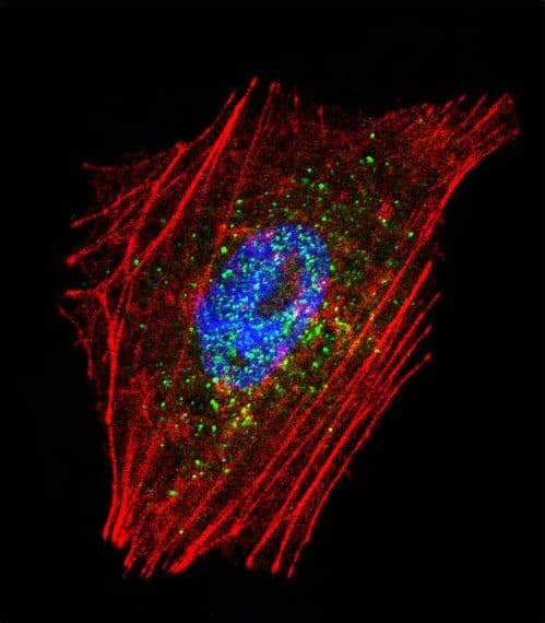 PARK2 / Parkin 2 Antibody (aa111-140)