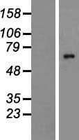 ALG8 Protein (Over-Expression Lysate Myc-DDK (Flag))