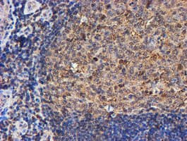 PSMB9 Antibody (aa21-219, clone OTI1D1)