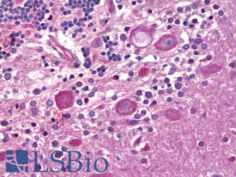 IHC-plus™ Tuberin / TSC2 Antibody (Ser1798)