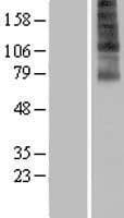 FSCN3 Protein (Over-Expression Lysate Myc-DDK (Flag))