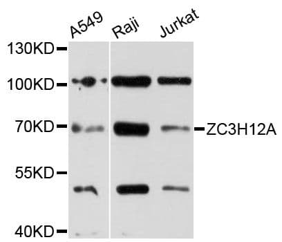 Polyclonal Rabbit anti-Human ZC3H12A / MCPIP1 Antibody (WB)