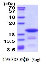 Human DTD2 Protein (Recombinant His)