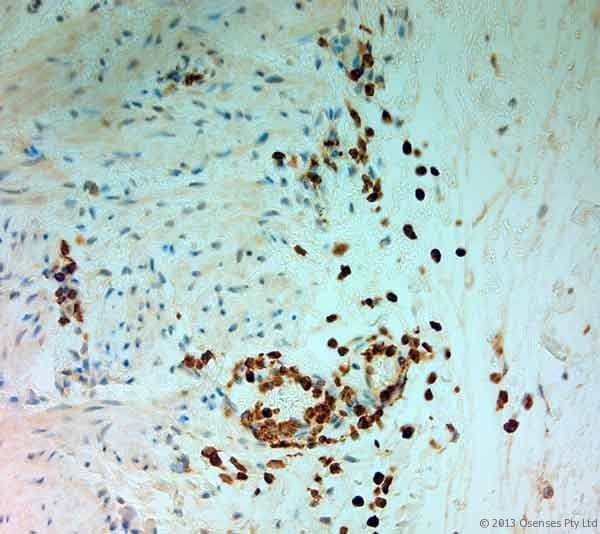 MPO / Myeloperoxidase Antibody
