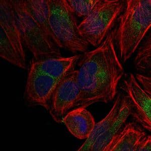 Monoclonal Mouse anti-Human JUN / c-Jun Antibody (clone 4H9, IHC, IF, WB)