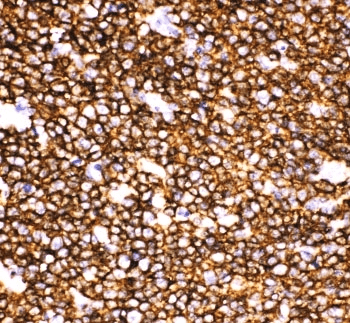 CD20 Antibody