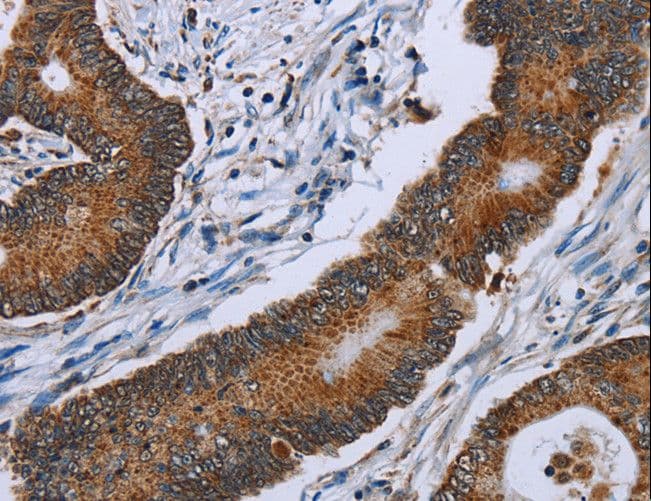 IDH2 Antibody