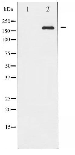 Polyclonal Rabbit anti-Human IRS1 Antibody (phospho-Ser636, IHC, IF, WB)