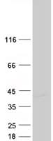 Human DIMT1L Protein (Recombinant Myc-DDK (Flag))