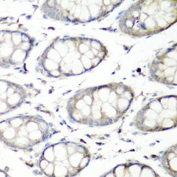 SH3GLB2 / Endophilin-B2 Antibody