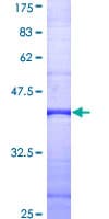 Human PLCD4 Protein (Recombinant GST, N-terminus)