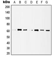 Polyclonal Rabbit anti-Human HDAC1 Antibody (C-Terminus, IHC, IF, WB)