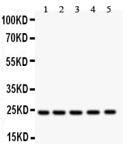 HSPB1 / HSP27 Antibody