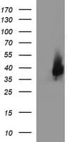 EPCAM Antibody (clone OTI1D4)