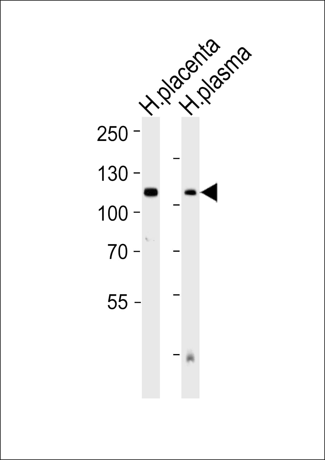 Polyclonal Rabbit anti-Human ENPP2 / Autotaxin Antibody (aa377-406, WB)