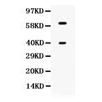 TPP1 / CLN2 Antibody (aa227-261)