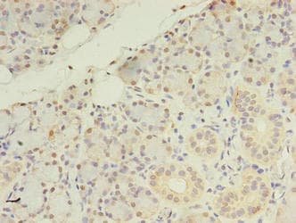 Polyclonal Rabbit anti-Human ZDHHC4 Antibody (IHC, WB)