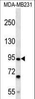 FSD2 Antibody (aa61-89)