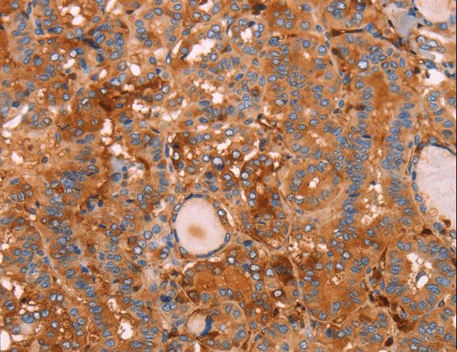 GC / Vitamin D-Binding Protein Antibody