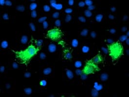 Nectin-1 / PVRL1 Antibody (clone OTI1B6)